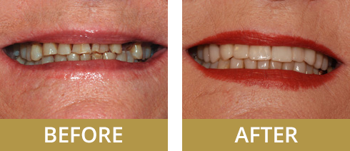Addison cosmetic dentistry patient.